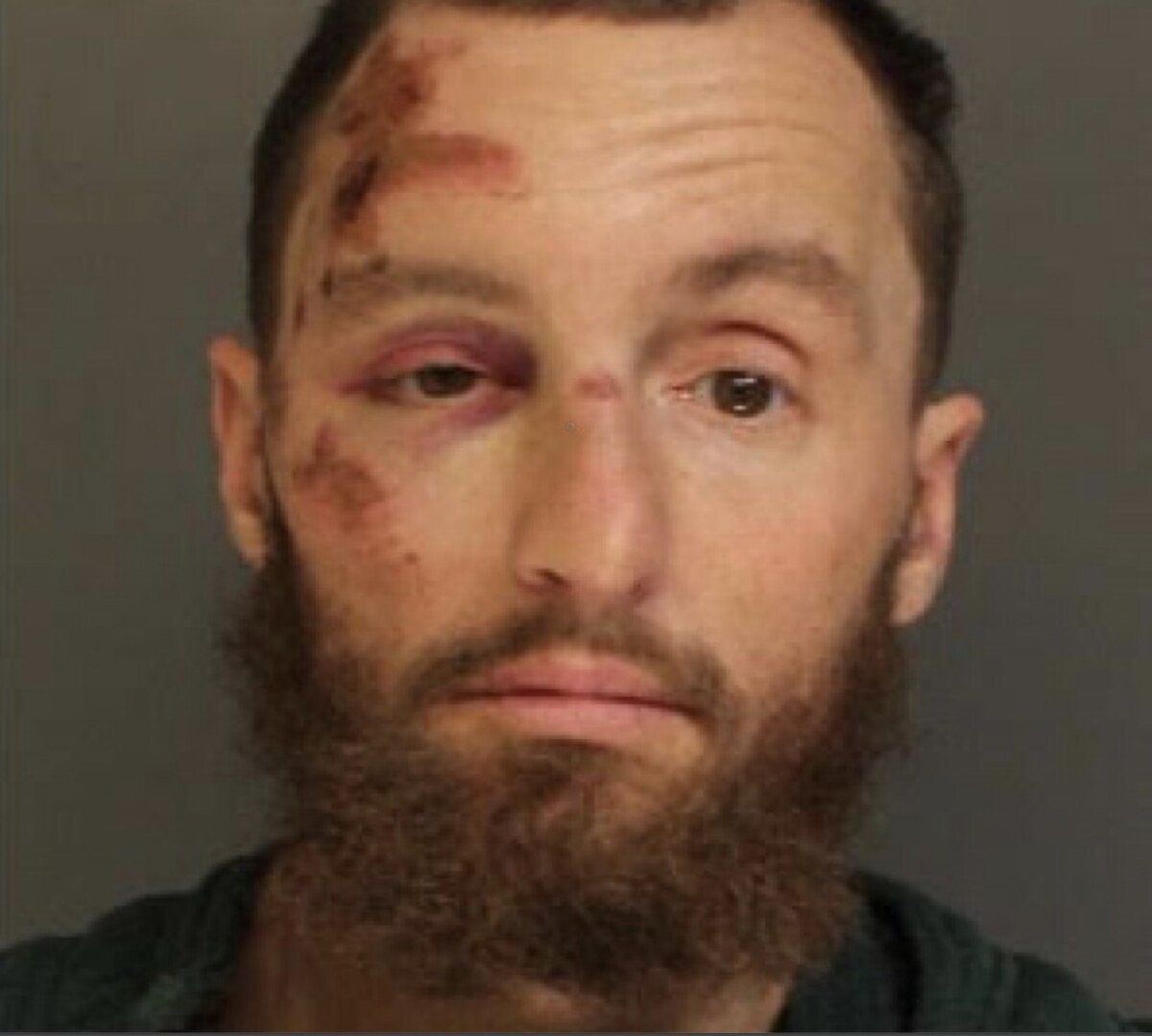 Pennsylvania man accused of intentionally hitting semi truck driver on foot with pickup truck at Fairfield Inn