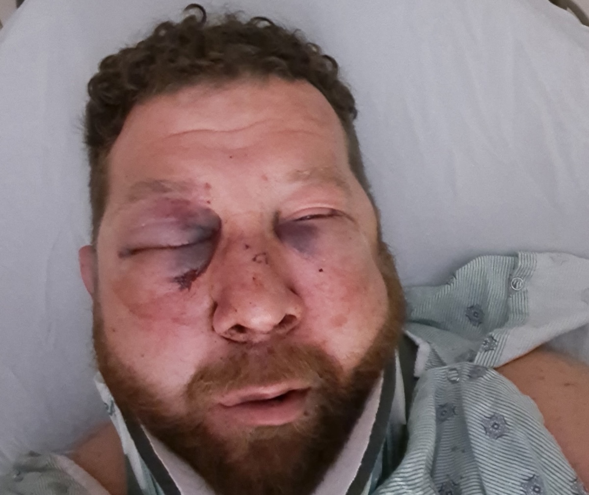 Driver’s company starts fundraiser after his severe beating outside Illinois truck stop